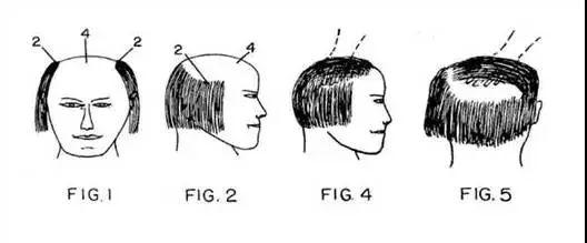 五款防止脫發(fā)的“正經(jīng)”專利！